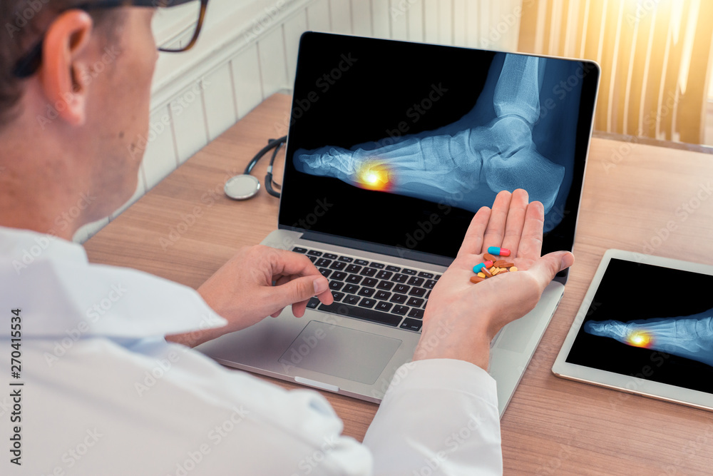 Doctor holding pills with x-ray with pain under the foot on a laptop. Digital tablet on the wooden desk