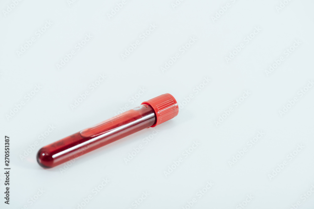 test tube with blood sample on white surface test tube with blood sample on white surface