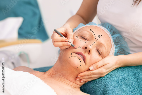 Procedure of facial rejuvenation for senior woman.
