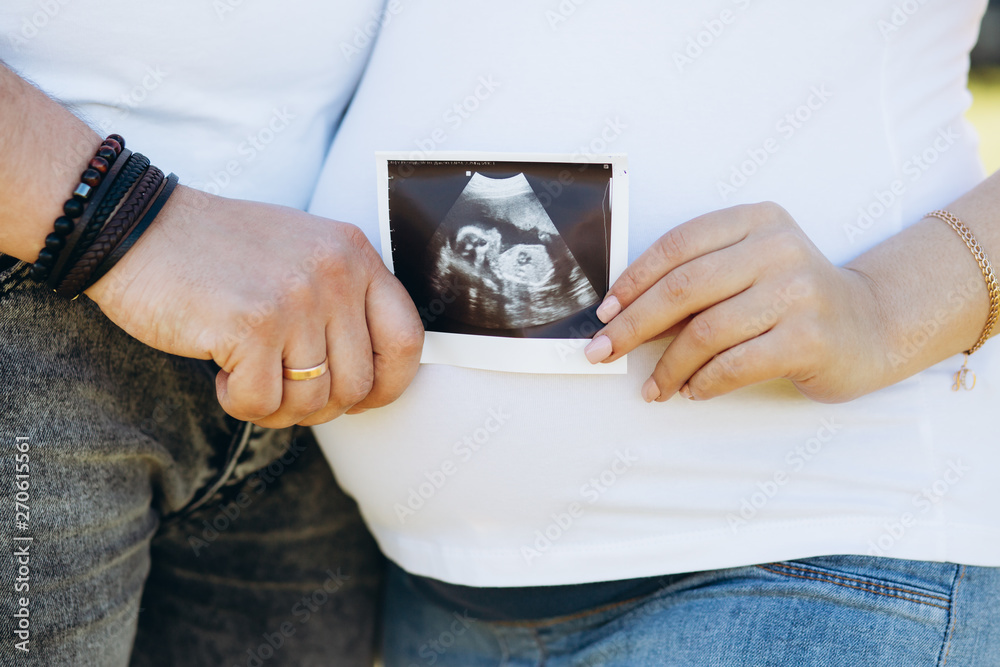 Pregnant couple holding ultrasound scan. Concept of Pregnancy health care. Pregnant couple holding ultrasound scan. Concept of Pregnancy health care.