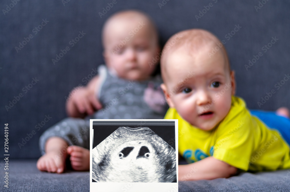 Naklejka premium Photo ultrasound twins. In the background are twins, a boy and a girl of 7 months. Maternity. Selective focus.