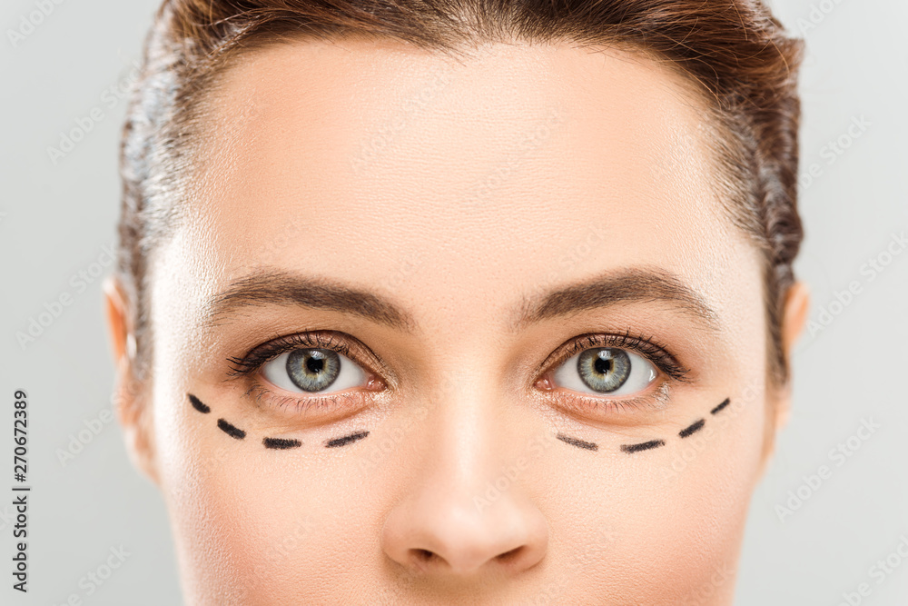 cropped view of woman with marks on face isolated on grey cropped view of woman with marks on face isolated on grey
