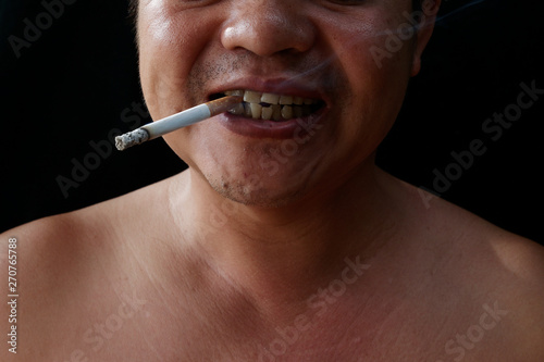 A man holding cigarette. Nicotine destroy teeth and gum healthy. it make effect Yellow stain, Tooth decay and Bad breath. world no tobacoo day.