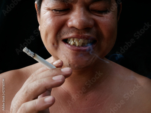 A man holding cigarette. Nicotine destroy teeth and gum healthy. it make effect Yellow stain, Tooth decay and Bad breath. world no tobacoo day.