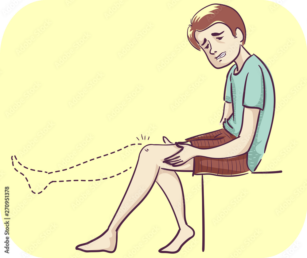 Man Joint Lack Range Motion Illustration