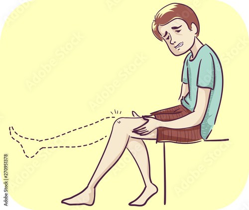 Man Joint Lack Range Motion Illustration