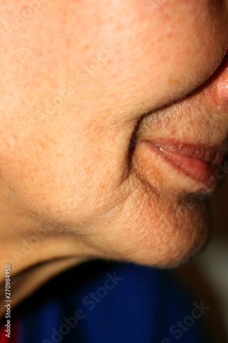 Sunken cheeks. Nasolabial folds on face. Wrinkles. photo