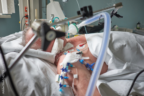 Intubated adult white man under ventilator lying in coma in intensive care department. Patient in critical state. photo