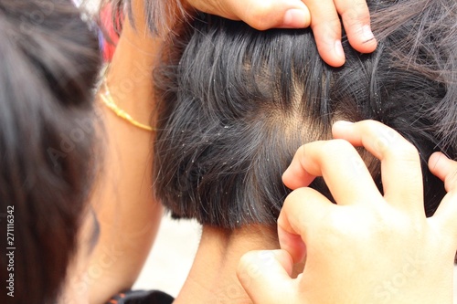 Girls lice on the head, filmed as blurred images