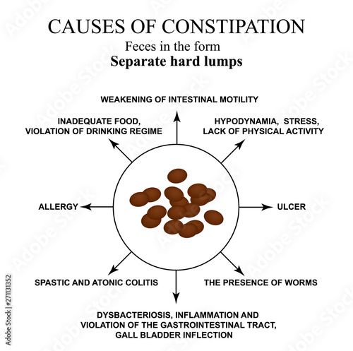 Causes of constipation. Sheep feces Infographics. Vector illustration on isolated background.