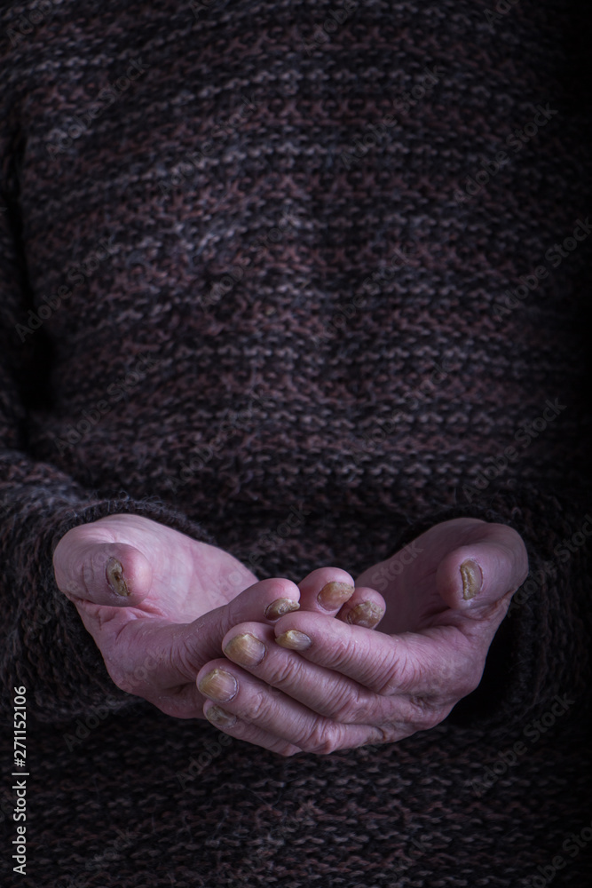 Fototapeta premium The palms of an old person in a dark, rough sweater are folded together, a concept of help, care and health, a background or concept