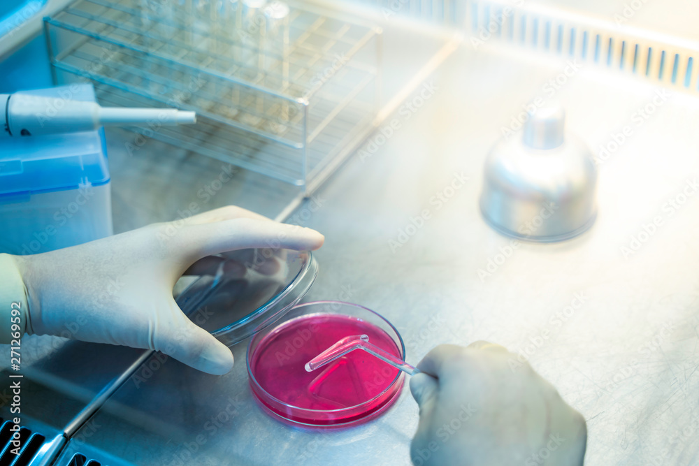 Hands of scientists are working on research.Bacteria in agar sheets