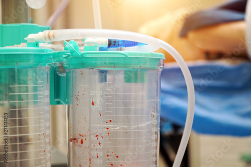 V suction for blood in the operating room of a hospital