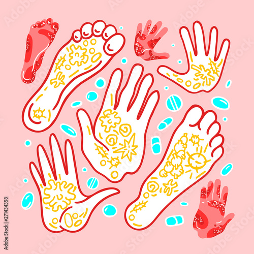 Skin diseases. Vector dermatology set. Eczema. Medicine