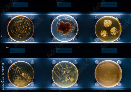 Schilderij op canvas different samples with kinds of bacterias living at common household items- mattress, shoe, moisturizer