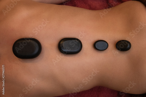 Woman receiving a therapy with hot stones in spa center, closeup photo