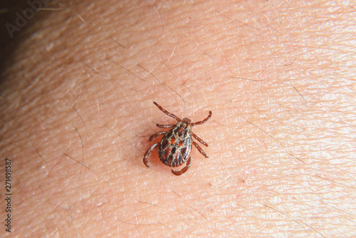 Forest mite on the skin. wood tick