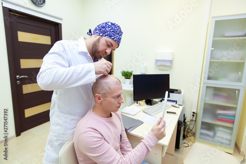 Baldness treatment. Patient suffering from hair loss in consultation with a doctor. Preparation for hair transplant surgery. The line marking the growth of hair. The patient controls the marking in © satyrenko
