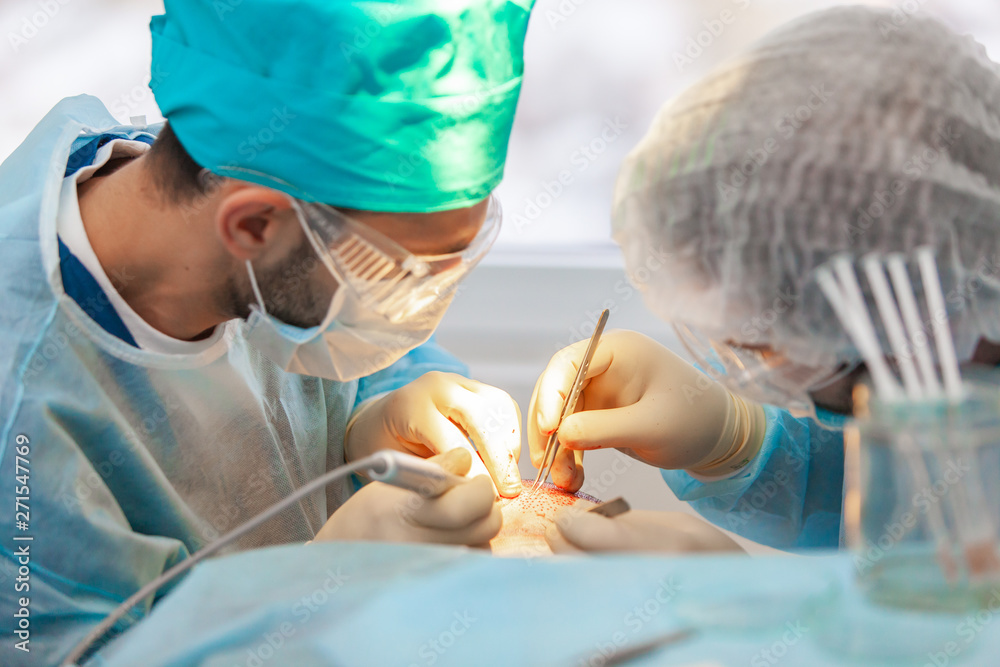 Baldness Treatment Hair Transplant Surgeons In The Operating Room Baldness Treatment Hair Transplant Surgeons In The Operating Room