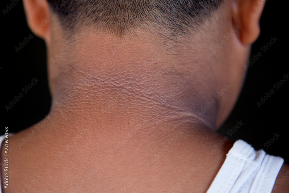 Obraz premium The child with the back of the black neck.