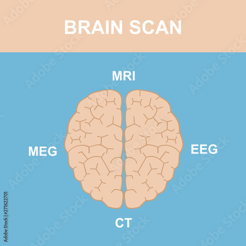 Brain Scan 1