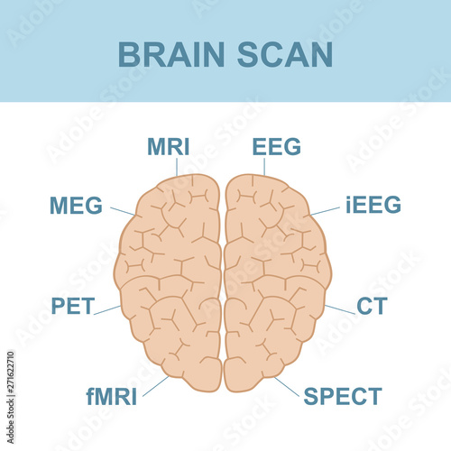 Brain Scan