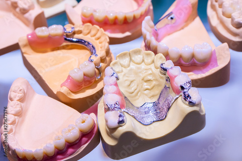 Photos The sandwich denture