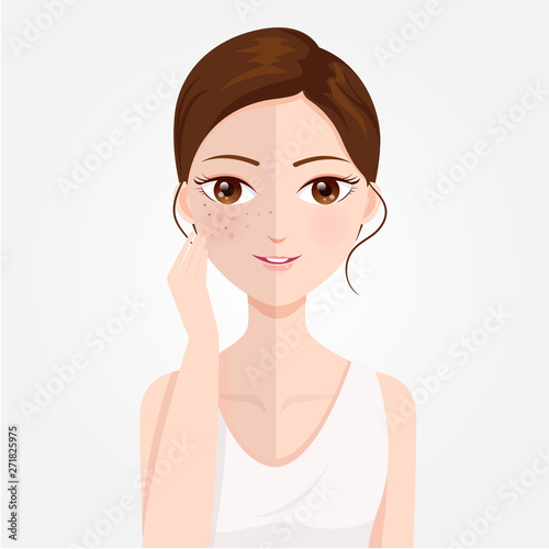 Black spots on the face