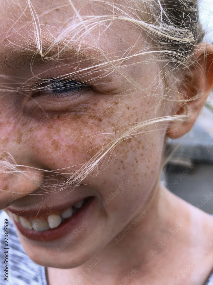 Close-up of a mischievous smiling girl with freckles 