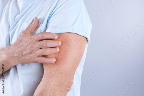Senior man scratching arm on grey background  closeup with space for text. Allergy symptom