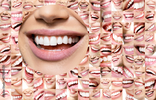 Conceptual background of laughing human faces with great teeth and detail of young woman's beautiful smile . Healthy beautiful male and female smiles. Teeth health, whitening, prosthetics and care.