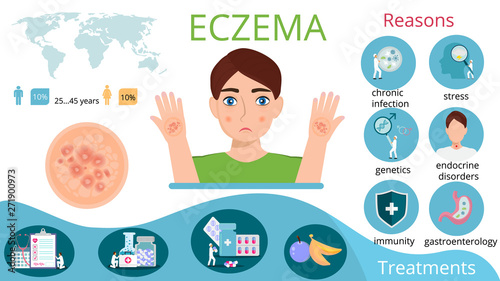 Infographics of eczema with reasons, man, pills, map, bacteria, immunity, endocrine, stress signes. Medical concept vector of ctatistics, treatment, disease.