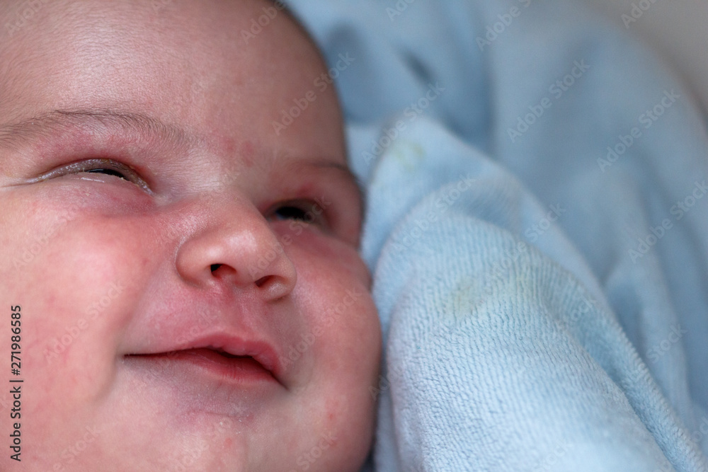 The purulent eye processed by tetracycline ointment Conjunctivitis, treatment of the newborn The purulent eye processed by tetracycline ointment Conjunctivitis, treatment of the newborn