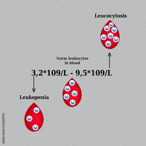 White blood cell count. Leukopenia. Leukocytosis. Infographics. Vector illustration photo