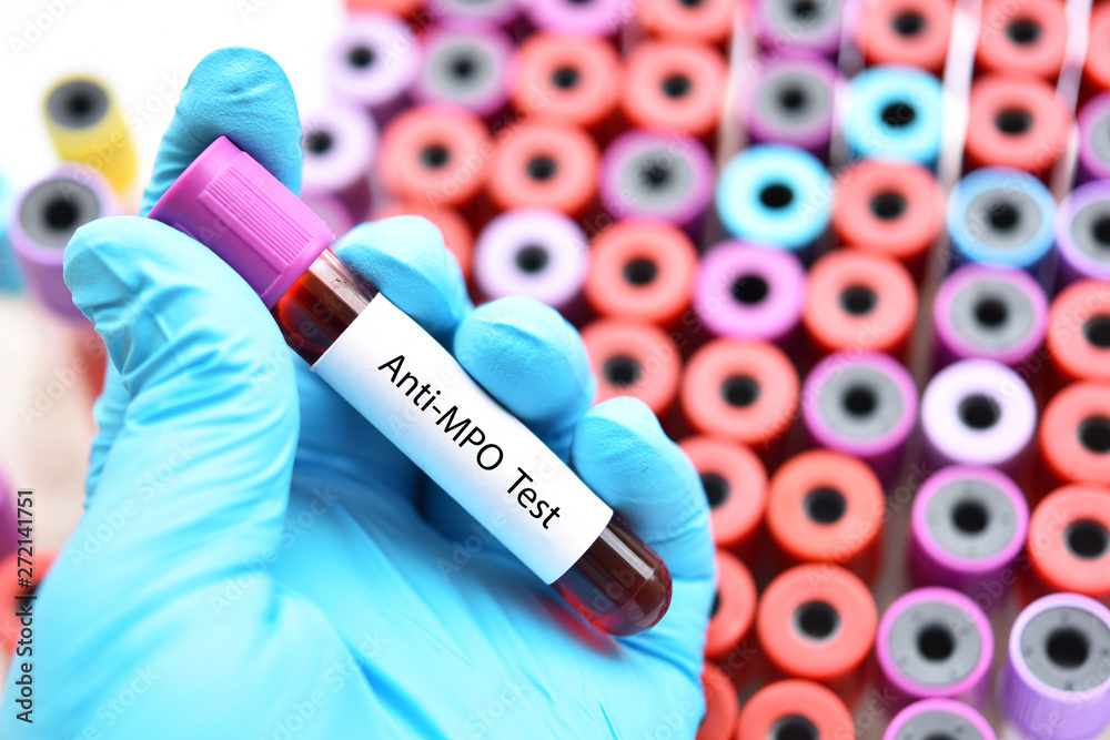 Obraz premium Test tube with blood sample for anti-MPO test