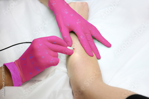 Foto Women's hand in unusual gloves when removing hair with an electric hair removal