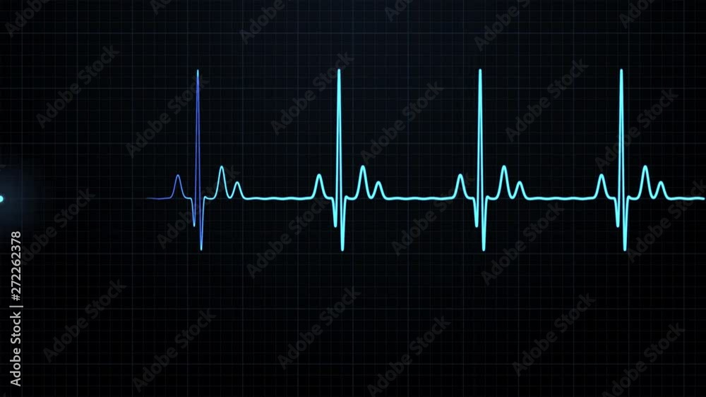 Loopable: Blue EKG/ECG cardiogram oscilloscope monitor heartbeat line chart shows 60 BPM heart rate on black background with grid.