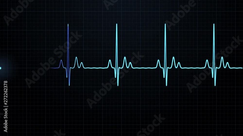 Loopable: Blue EKG/ECG cardiogram oscilloscope monitor heartbeat line chart shows 60 BPM heart rate on black background with grid.