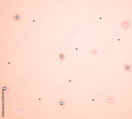Stage 1 of development of acne. Inflamed skin with scars, acne and pimples. The texture of inflamed skin, and acne and pimples. Infographics. Vector illustration.