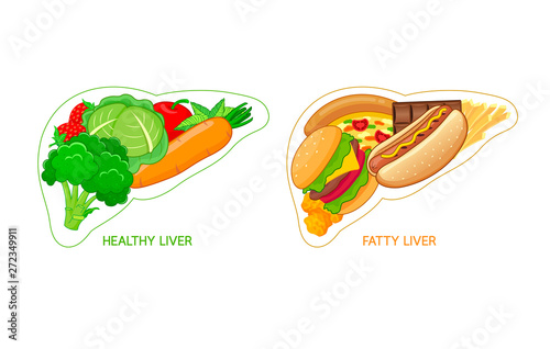 Healthy and unhealthy food in shape of liver. Fatty liver awareness concept.  Vector illustration isolated on white background.