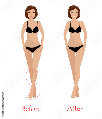 Woman epilation concept - before and after unwanted hair removing. Happy girl after armpit, bikini, and legs epilation. Vector illustration