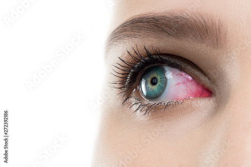 Fototapeta Naklejka Na Ścianę i Meble -  Eye inflammation. Female open red sight with contact lens , close up.