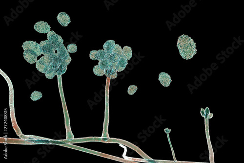 Stachybotrys chartarum mould, a toxic mould, a common fungi found in indoor air and causing mycotoxicosis, chronic fatigue, allergic diseases and other health problems, 3D illustration photo