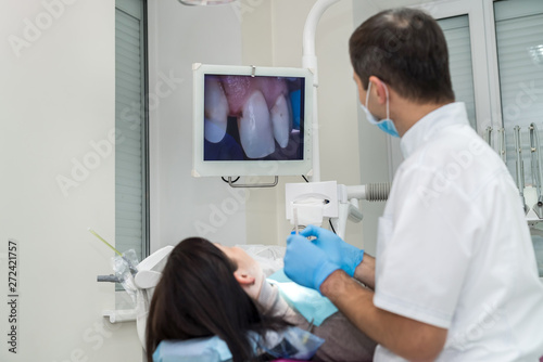 Dentist checking patient s teeth with camera in stomatology