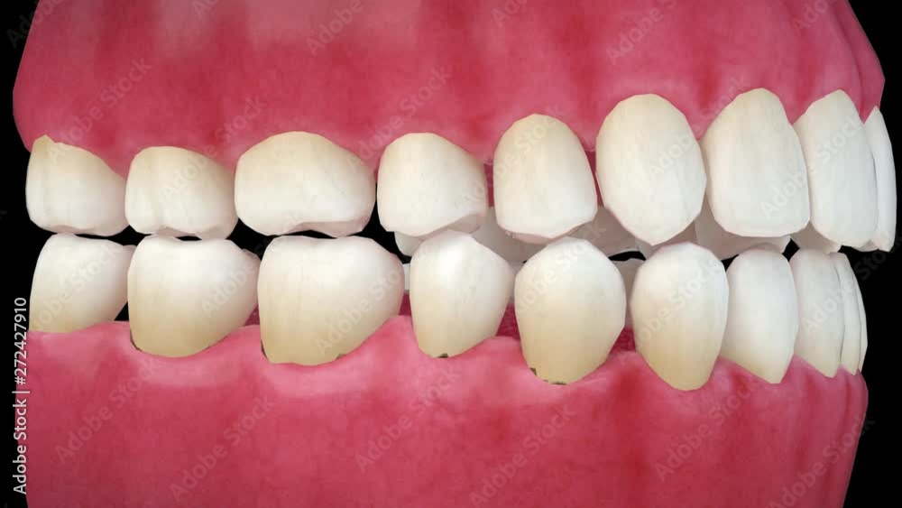 teeth and gums