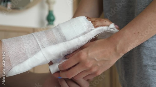 Doctor taking care of a broken arm splint around the gips