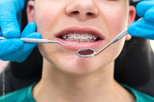 dentist looking at the mouth with tools and mirror