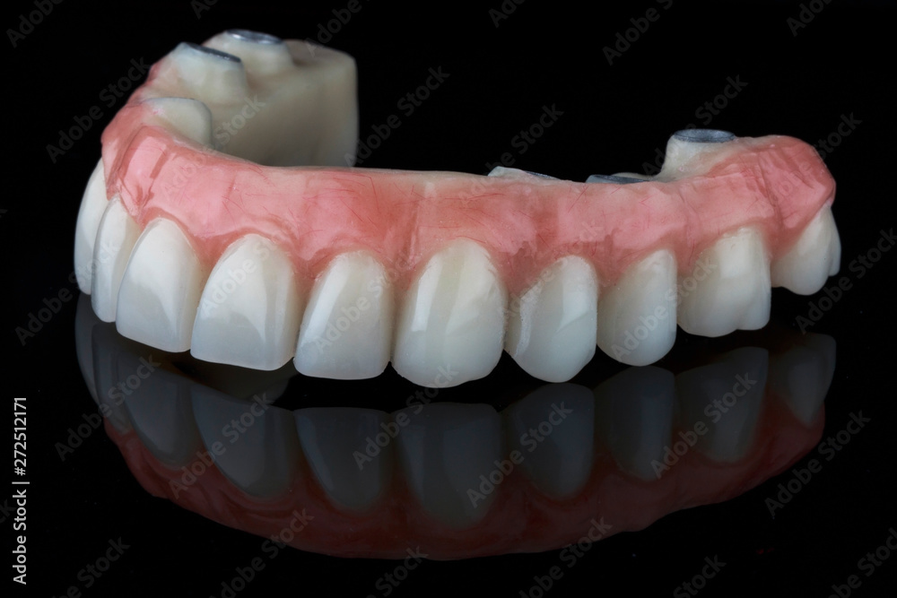 excellent angle dental upper limb prosthesis on black glass excellent angle dental upper limb prosthesis on black glass