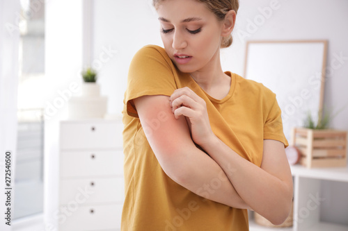 Woman scratching arm indoors, space for text. Allergy symptoms