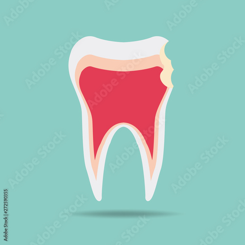 tooth wear brace on the blue background